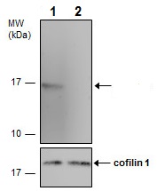 Western blot - Anti-CDKN2A/p14ARF antibody (AB227808)