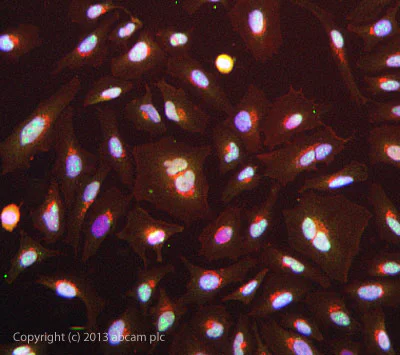 Immunocytochemistry/ Immunofluorescence - Anti-CDKN2A/p14ARF antibody (AB3642)