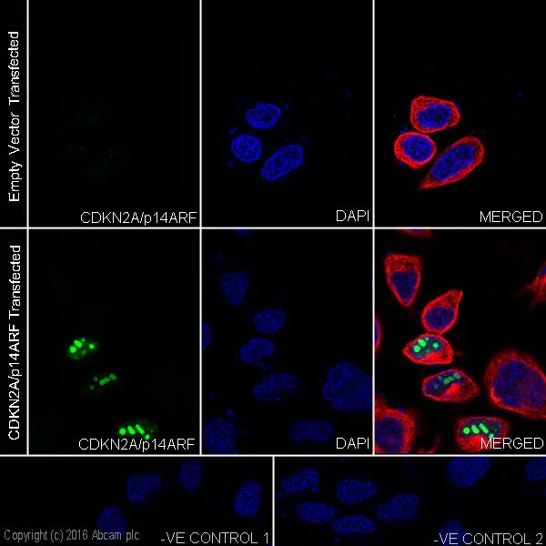 Immunocytochemistry/ Immunofluorescence - Anti-CDKN2A/p14ARF antibody (AB3642)