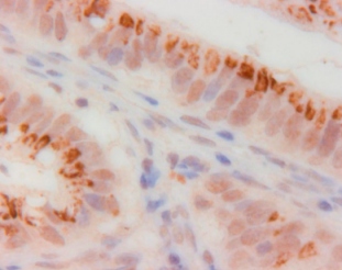 Immunohistochemistry (Formalin/PFA-fixed paraffin-embedded sections) - Anti-CDKN2A/p14ARF antibody (AB3642)