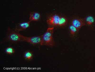 Immunocytochemistry/ Immunofluorescence - Anti-CDKN2A/p14ARF antibody [ARF 4C6/4] (AB11048)