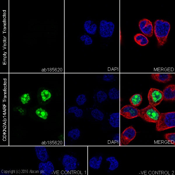 Immunocytochemistry/ Immunofluorescence - Anti-CDKN2A/p14ARF antibody [EPR17878] (AB185620), expandable thumbnail