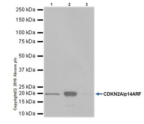 Immunoprecipitation - Anti-CDKN2A/p14ARF antibody [EPR17878] (AB185620), expandable thumbnail