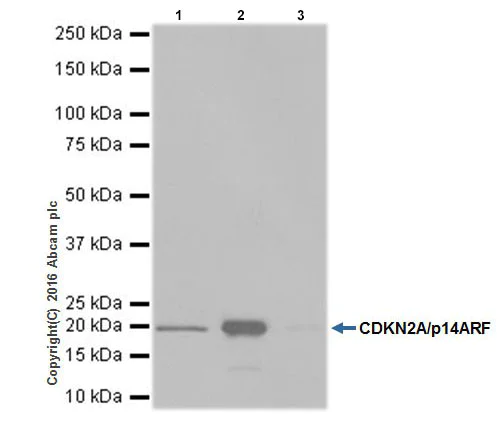 Immunoprecipitation - Anti-CDKN2A/p14ARF antibody [EPR17878] (AB185620)