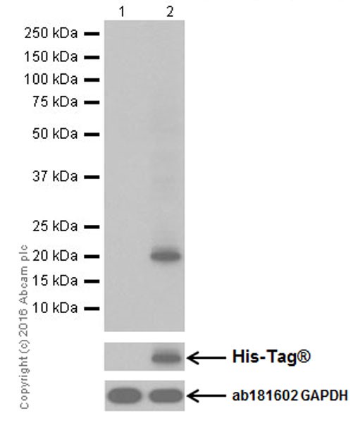 Western blot - Anti-CDKN2A/p14ARF antibody [EPR17878] (AB185620), expandable thumbnail