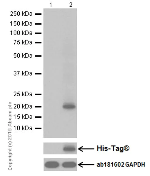Western blot - Anti-CDKN2A/p14ARF antibody [EPR17878] (AB185620)