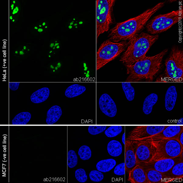 Immunocytochemistry/ Immunofluorescence - Anti-CDKN2A/p14ARF antibody [SP271] (AB216602), expandable thumbnail