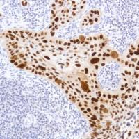 Immunohistochemistry (Formalin/PFA-fixed paraffin-embedded sections) - Anti-CDKN2A/p14ARF antibody [SP271] - BSA and Azide free (AB271999), expandable thumbnail