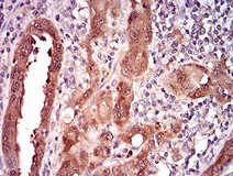 Immunohistochemistry (Formalin/PFA-fixed paraffin-embedded sections) - Anti-CDKN2A/p16INK4a antibody [1D7D2A1] (AB201980)