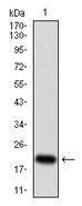 Western blot - Anti-CDKN2A/p16INK4a antibody [1D7D2A1] (AB201980)