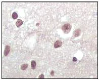 Immunohistochemistry (Formalin/PFA-fixed paraffin-embedded sections) - Anti-CDKN2A/p16INK4a antibody [2D9A12] (AB54210)