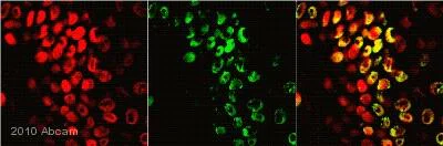 Immunohistochemistry (Formalin/PFA-fixed paraffin-embedded sections) - Anti-CDKN2A/p16INK4a antibody [2D9A12] (AB54210)