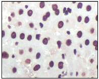 Immunohistochemistry (Formalin/PFA-fixed paraffin-embedded sections) - Anti-CDKN2A/p16INK4a antibody [2D9A12] (ab54210), expandable thumbnail