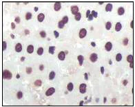 Immunohistochemistry (Formalin/PFA-fixed paraffin-embedded sections) - Anti-CDKN2A/p16INK4a antibody [2D9A12] (AB54210)