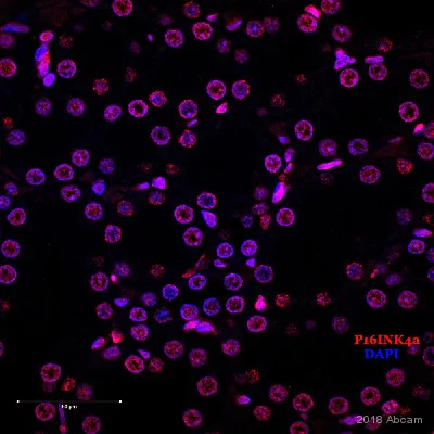 Immunohistochemistry (Formalin/PFA-fixed paraffin-embedded sections) - Anti-CDKN2A/p16INK4a antibody [2D9A12] (AB54210)