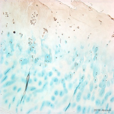 Immunohistochemistry (Formalin/PFA-fixed paraffin-embedded sections) - Anti-CDKN2A/p16INK4a antibody [2D9A12] (AB54210), expandable thumbnail