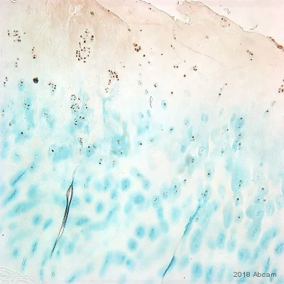 Immunohistochemistry (Formalin/PFA-fixed paraffin-embedded sections) - Anti-CDKN2A/p16INK4a antibody [2D9A12] (AB54210)