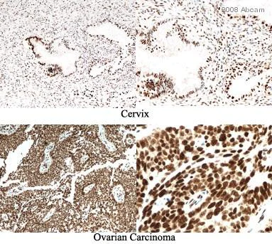 p16INK4a antibody [2D9A12] - mouse monoclonal (ab54210) | Abcam