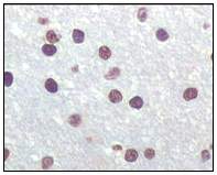 Immunohistochemistry (Formalin/PFA-fixed paraffin-embedded sections) - Anti-CDKN2A/p16INK4a antibody [2D9A12] (ab54210), expandable thumbnail