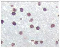 Immunohistochemistry (Formalin/PFA-fixed paraffin-embedded sections) - Anti-CDKN2A/p16INK4a antibody [2D9A12] (AB54210)