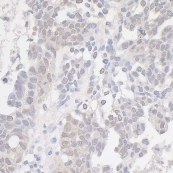 Immunohistochemistry (Formalin/PFA-fixed paraffin-embedded sections) - Anti-CDKN2A/p16INK4a antibody (AB264192), expandable thumbnail