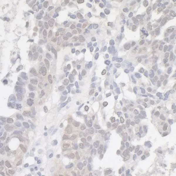 Immunohistochemistry (Formalin/PFA-fixed paraffin-embedded sections) - Anti-CDKN2A/p16INK4a antibody (AB264192)