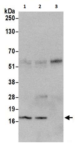Immunoprecipitation - Anti-CDKN2A/p16INK4a antibody (AB264192), expandable thumbnail