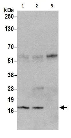 Immunoprecipitation - Anti-CDKN2A/p16INK4a antibody (AB264192)