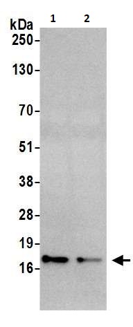 Western blot - Anti-CDKN2A/p16INK4a antibody (AB264192), expandable thumbnail
