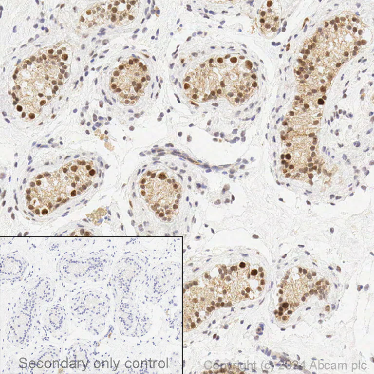 Immunohistochemistry (Formalin/PFA-fixed paraffin-embedded sections) - Anti-CDKN2A/p16INK4a antibody [EPR1473] - BSA and Azide free (AB186932)