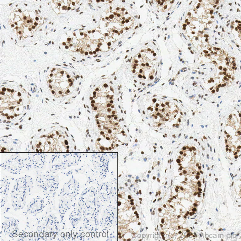 Immunohistochemistry (Formalin/PFA-fixed paraffin-embedded sections) - Anti-CDKN2A/p16INK4a antibody [EPR1473] - BSA and Azide free (AB186932)