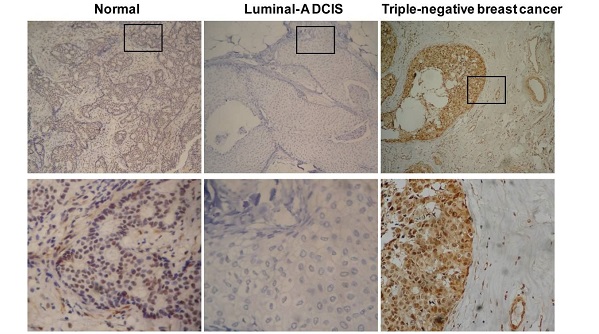 Immunohistochemistry (Formalin/PFA-fixed paraffin-embedded sections) - Anti-CDKN2A/p16INK4a antibody [EPR1473] - BSA and Azide free (AB186932), expandable thumbnail
