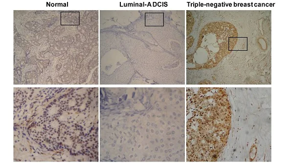 Immunohistochemistry (Formalin/PFA-fixed paraffin-embedded sections) - Anti-CDKN2A/p16INK4a antibody [EPR1473] - BSA and Azide free (AB186932)