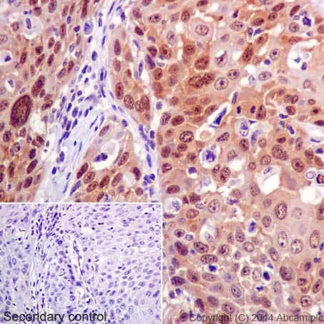 Immunohistochemistry (Formalin/PFA-fixed paraffin-embedded sections) - Anti-CDKN2A/p16INK4a antibody [EPR1473] - BSA and Azide free (AB186932)