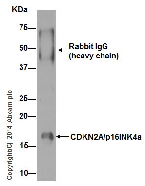 Immunoprecipitation - Anti-CDKN2A/p16INK4a antibody [EPR1473] - BSA and Azide free (AB186932), expandable thumbnail