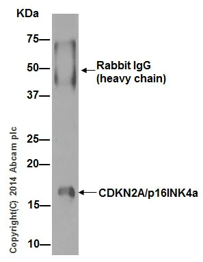 Immunoprecipitation - Anti-CDKN2A/p16INK4a antibody [EPR1473] - BSA and Azide free (AB186932)