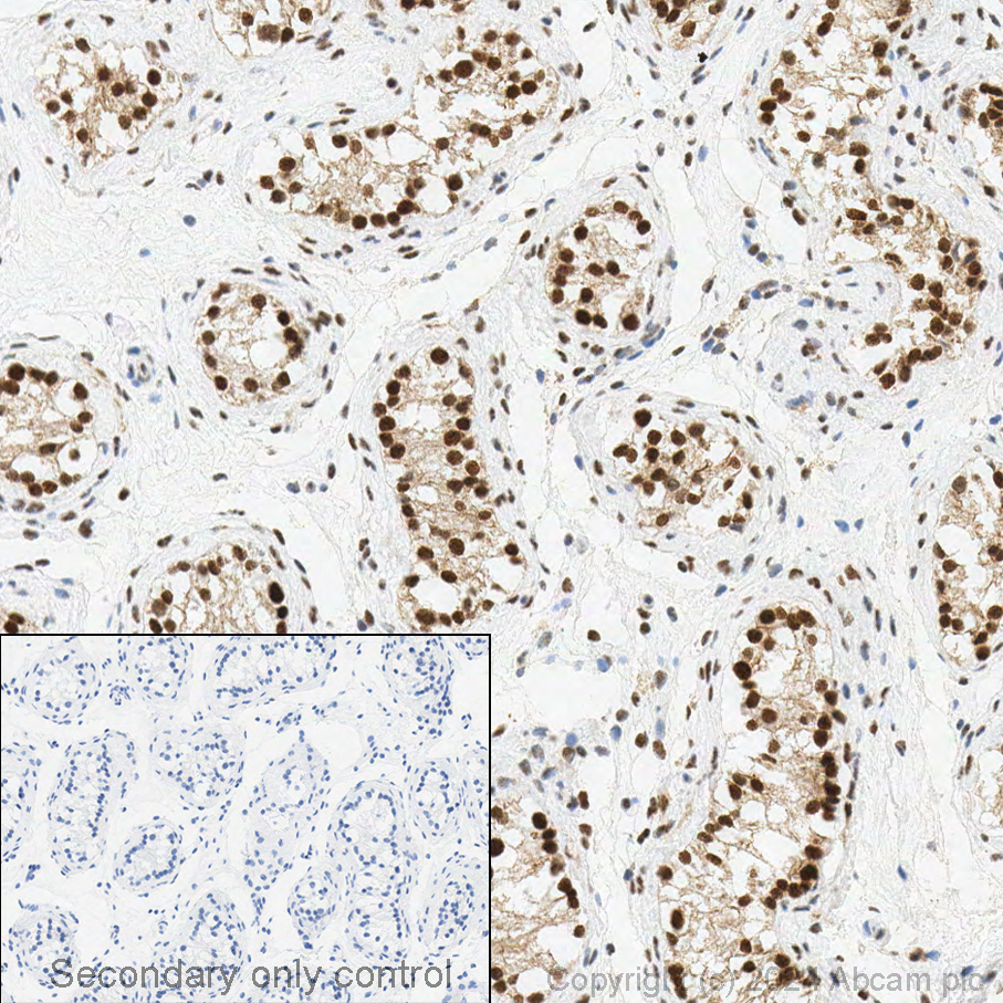 Immunohistochemistry (Formalin/PFA-fixed paraffin-embedded sections) - Anti-CDKN2A/p16INK4a antibody [EPR1473] - C-terminal (ab108349), expandable thumbnail