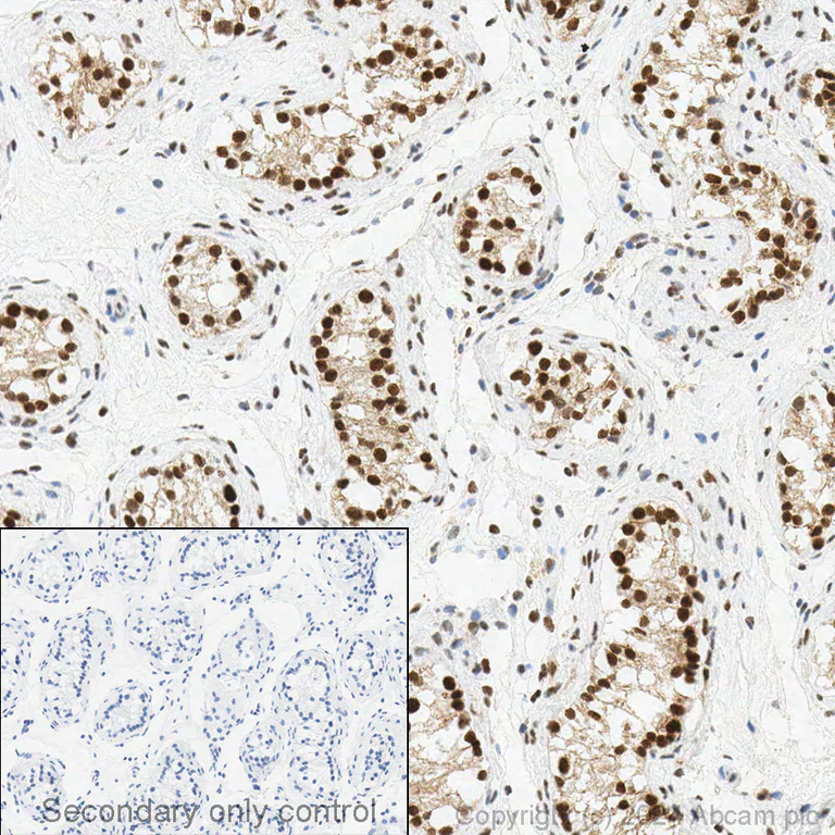 Immunohistochemistry (Formalin/PFA-fixed paraffin-embedded sections) - Anti-CDKN2A/p16INK4a antibody [EPR1473] - C-terminal (AB108349)
