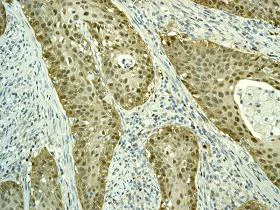 Immunohistochemistry (Formalin/PFA-fixed paraffin-embedded sections) - Anti-CDKN2A/p16INK4a antibody [EPR1473] - C-terminal (AB108349)
