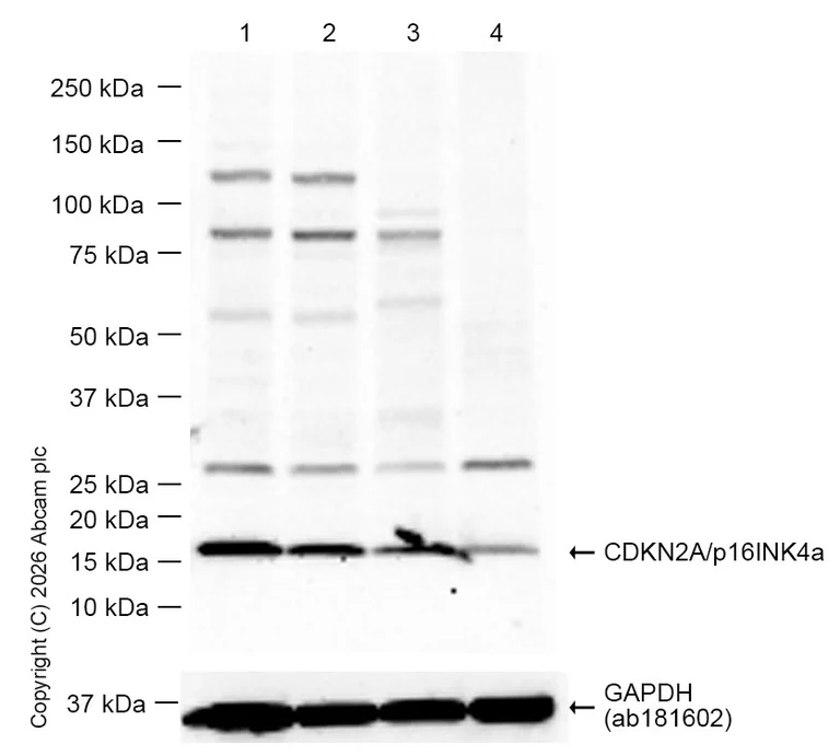 Western blot - Anti-CDKN2A/p16INK4a antibody [EPR1473] - C-terminal (AB108349)