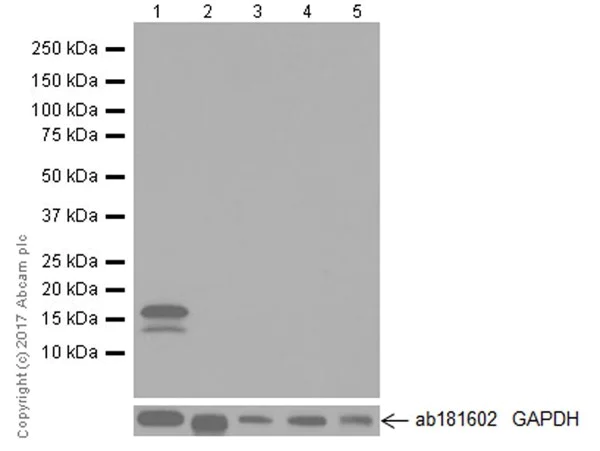 Western blot - Anti-CDKN2A/p16INK4a antibody [EPR20418] (AB211542)