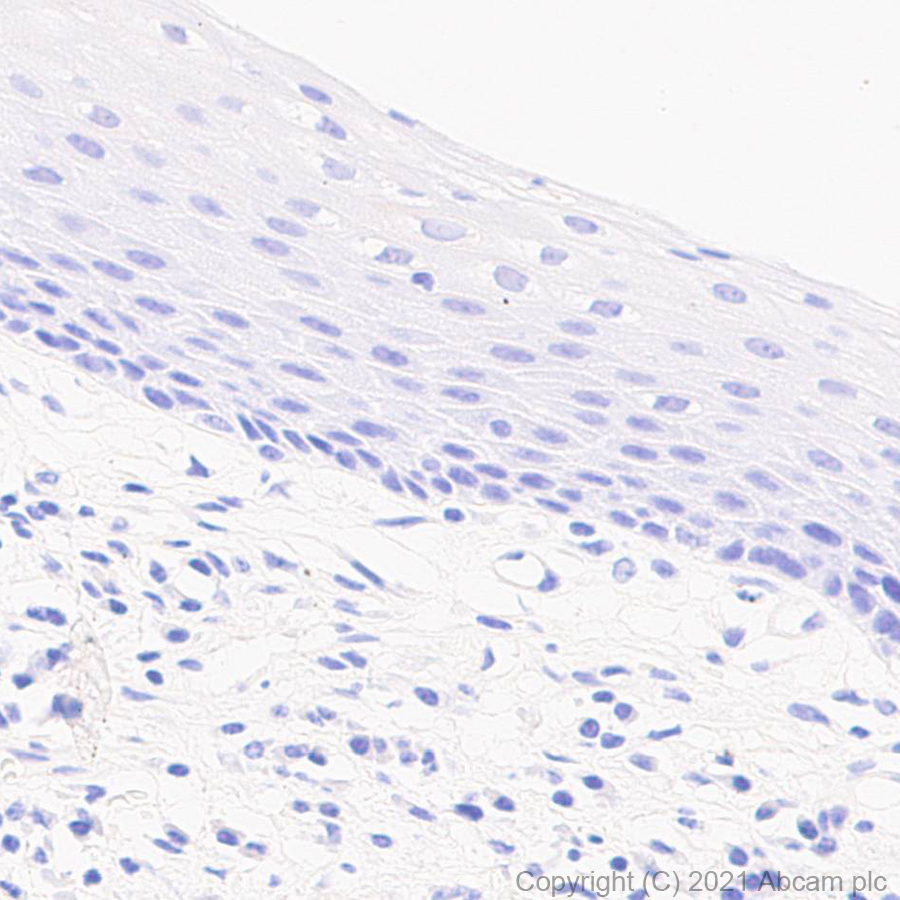 Immunohistochemistry (Formalin/PFA-fixed paraffin-embedded sections) - Anti-CDKN2A/p16INK4a antibody [EPR24167-43] (AB270058), expandable thumbnail