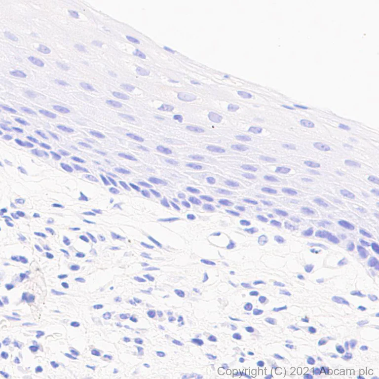 Immunohistochemistry (Formalin/PFA-fixed paraffin-embedded sections) - Anti-CDKN2A/p16INK4a antibody [EPR24167-43] (AB270058)