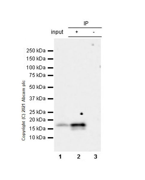 Immunoprecipitation - Anti-CDKN2A/p16INK4a antibody [EPR24167-43] (ab270058), expandable thumbnail
