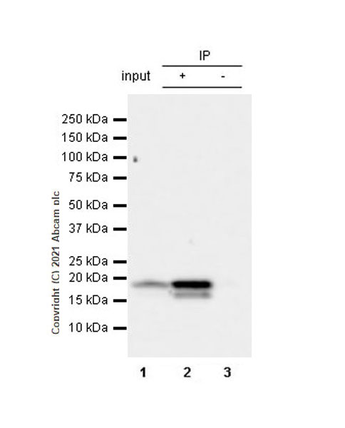 Immunoprecipitation - Anti-CDKN2A/p16INK4a antibody [EPR24167-43] (ab270058), expandable thumbnail