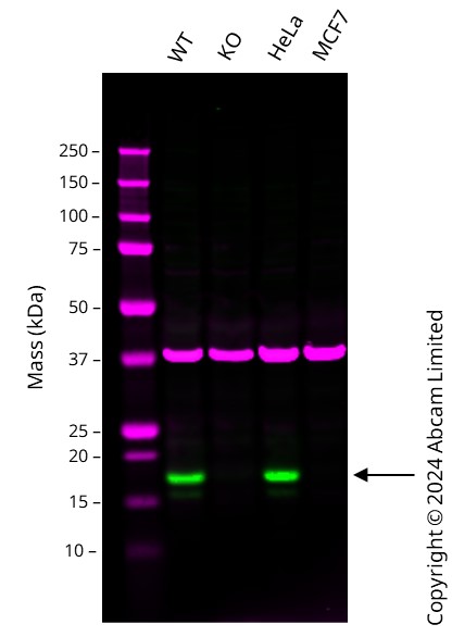 Western blot - Anti-CDKN2A/p16INK4a antibody [EPR24167-43] (ab270058), expandable thumbnail