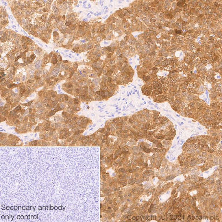 Immunohistochemistry (Formalin/PFA-fixed paraffin-embedded sections) - Anti-CDKN2A/p16INK4a antibody [EPR24167-43] - BSA and Azide free (AB282285)