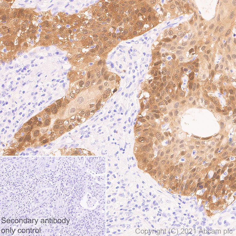 Immunohistochemistry (Formalin/PFA-fixed paraffin-embedded sections) - Anti-CDKN2A/p16INK4a antibody [EPR24167-43] - BSA and Azide free (AB282285)