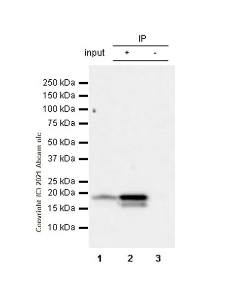 Immunoprecipitation - Anti-CDKN2A/p16INK4a antibody [EPR24167-43] - BSA and Azide free (AB282285)