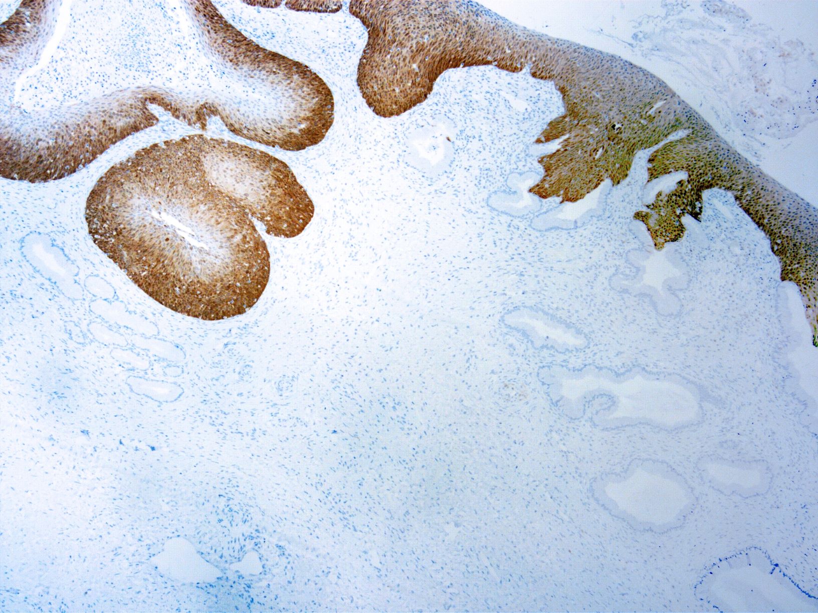 Immunohistochemistry (Formalin/PFA-fixed paraffin-embedded sections) - Anti-CDKN2A/p16INK4a antibody [JC2] (AB267833), expandable thumbnail